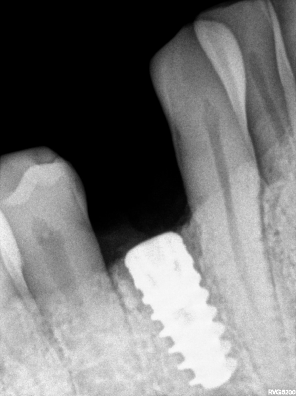Dental X-ray